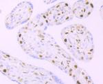 MCM3 Antibody in Immunohistochemistry (Paraffin) (IHC (P))