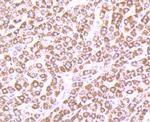 CPS1 Antibody in Immunohistochemistry (Paraffin) (IHC (P))