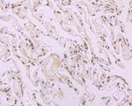 SRSF1 Antibody in Immunohistochemistry (Paraffin) (IHC (P))