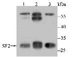 SRSF1 Antibody in Western Blot (WB)