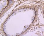 GSTP1 Antibody in Immunohistochemistry (Paraffin) (IHC (P))