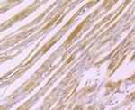 H-cadherin Antibody in Immunohistochemistry (Paraffin) (IHC (P))