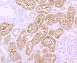 H-cadherin Antibody in Immunohistochemistry (Paraffin) (IHC (P))