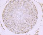 MBD3 Antibody in Immunohistochemistry (Paraffin) (IHC (P))