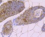 Desmoglein 1 Antibody in Immunohistochemistry (Paraffin) (IHC (P))