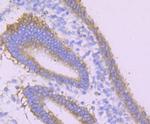 Desmoglein 1 Antibody in Immunohistochemistry (Paraffin) (IHC (P))