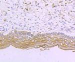 Desmoglein 1 Antibody in Immunohistochemistry (Paraffin) (IHC (P))