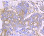 Desmoglein 1 Antibody in Immunohistochemistry (Paraffin) (IHC (P))