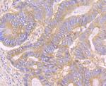 CD46 Antibody in Immunohistochemistry (Paraffin) (IHC (P))