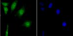 CaMKIV Antibody in Immunocytochemistry (ICC/IF)