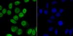 CaMKIV Antibody in Immunocytochemistry (ICC/IF)