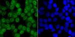 CaMKIV Antibody in Immunocytochemistry (ICC/IF)