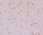 CaMKIV Antibody in Immunohistochemistry (Paraffin) (IHC (P))