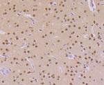 CaMKIV Antibody in Immunohistochemistry (Paraffin) (IHC (P))