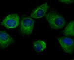 Arp3 Antibody in Immunocytochemistry (ICC/IF)