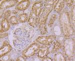 Arp3 Antibody in Immunohistochemistry (Paraffin) (IHC (P))