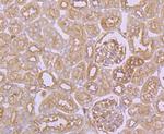 Arp3 Antibody in Immunohistochemistry (Paraffin) (IHC (P))