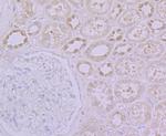 GPI Antibody in Immunohistochemistry (Paraffin) (IHC (P))