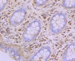 GPI Antibody in Immunohistochemistry (Paraffin) (IHC (P))