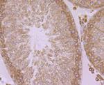 ERP29 Antibody in Immunohistochemistry (Paraffin) (IHC (P))