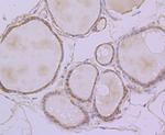 ERP29 Antibody in Immunohistochemistry (Paraffin) (IHC (P))