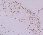 PRP8 Antibody in Immunohistochemistry (Paraffin) (IHC (P))