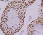 PRP8 Antibody in Immunohistochemistry (Paraffin) (IHC (P))