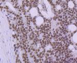 PRP8 Antibody in Immunohistochemistry (Paraffin) (IHC (P))