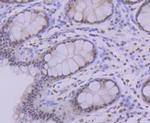 PRP8 Antibody in Immunohistochemistry (Paraffin) (IHC (P))