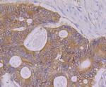 PON2 Antibody in Immunohistochemistry (Paraffin) (IHC (P))