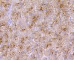 TFR2 Antibody in Immunohistochemistry (Paraffin) (IHC (P))