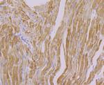 NDUFB8 Antibody in Immunohistochemistry (Paraffin) (IHC (P))