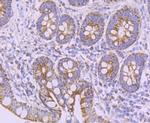 NDUFB8 Antibody in Immunohistochemistry (Paraffin) (IHC (P))