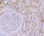 NDUFB8 Antibody in Immunohistochemistry (Paraffin) (IHC (P))