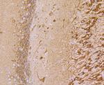 VAMP3 Antibody in Immunohistochemistry (Paraffin) (IHC (P))