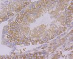 VAMP3 Antibody in Immunohistochemistry (Paraffin) (IHC (P))