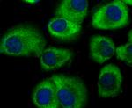 GEF-H1 Antibody in Immunocytochemistry (ICC/IF)