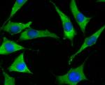 SOCS2 Antibody in Immunocytochemistry (ICC/IF)