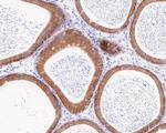 SOCS2 Antibody in Immunohistochemistry (Paraffin) (IHC (P))