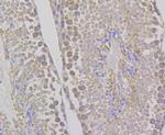 WNK1 Antibody in Immunohistochemistry (Paraffin) (IHC (P))