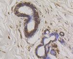 WNK1 Antibody in Immunohistochemistry (Paraffin) (IHC (P))