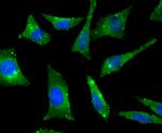 RHEB Antibody in Immunocytochemistry (ICC/IF)