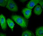 RHEB Antibody in Immunocytochemistry (ICC/IF)