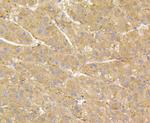 RHEB Antibody in Immunohistochemistry (Paraffin) (IHC (P))