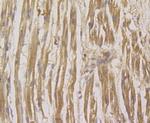 RHEB Antibody in Immunohistochemistry (Paraffin) (IHC (P))