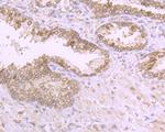 RANGAP1 Antibody in Immunohistochemistry (Paraffin) (IHC (P))