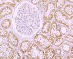 RANGAP1 Antibody in Immunohistochemistry (Paraffin) (IHC (P))