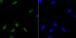 ILF3 Antibody in Immunocytochemistry (ICC/IF)