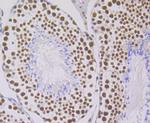 ILF3 Antibody in Immunohistochemistry (Paraffin) (IHC (P))