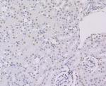 ILF3 Antibody in Immunohistochemistry (Paraffin) (IHC (P))